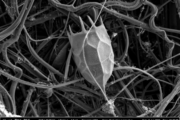A black and white photo of an umbrella shaped rotifer.